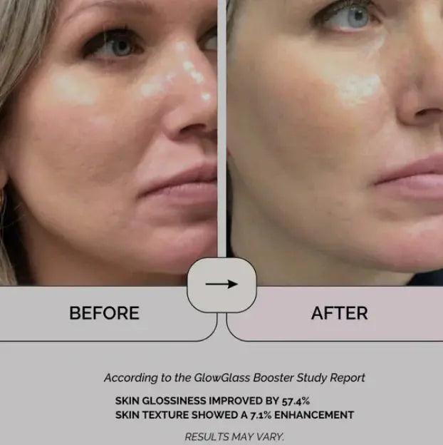 Glass Skin Booster - Facial Light - Skynnology