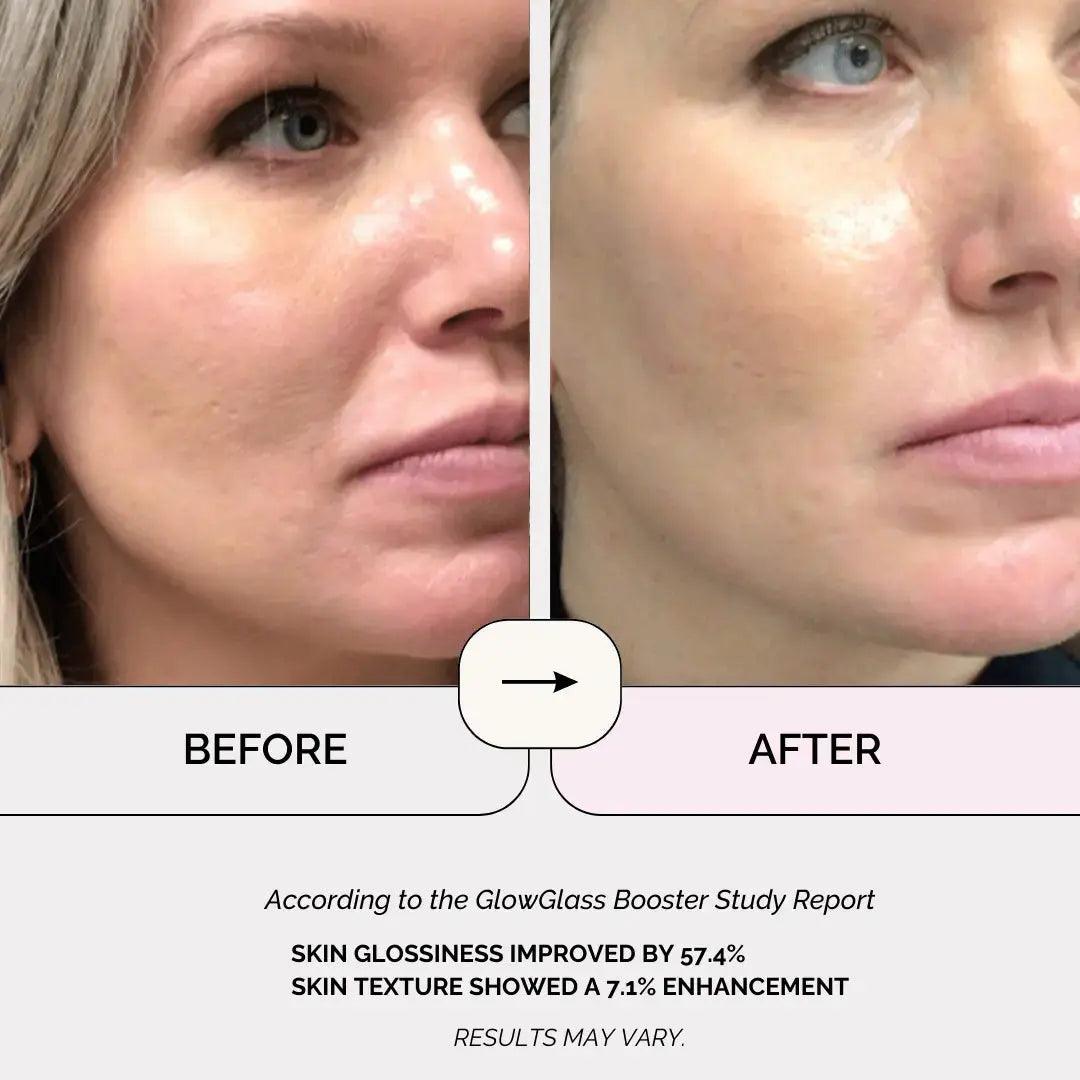 Glass Skin Booster - Facial Light - Skynnology